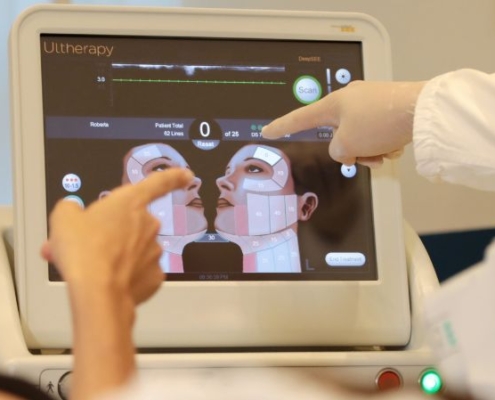 Visualizzazione ecografica nel lifting ad ultrasuoni microfocalizzati